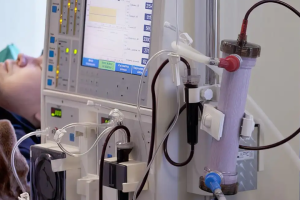 Estudo alerta para subdiagnóstico da doença renal crônica no Brasil