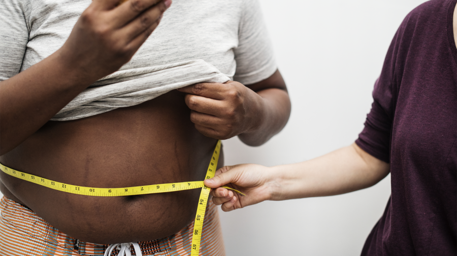 Em 30 anos, obesidade triplica e atinge 14 da população adulta
